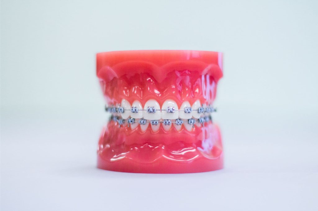 carnegie orthodontics